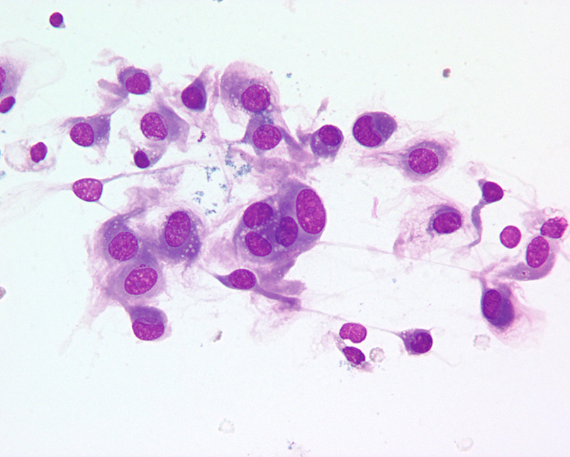 mesenchymal-feature